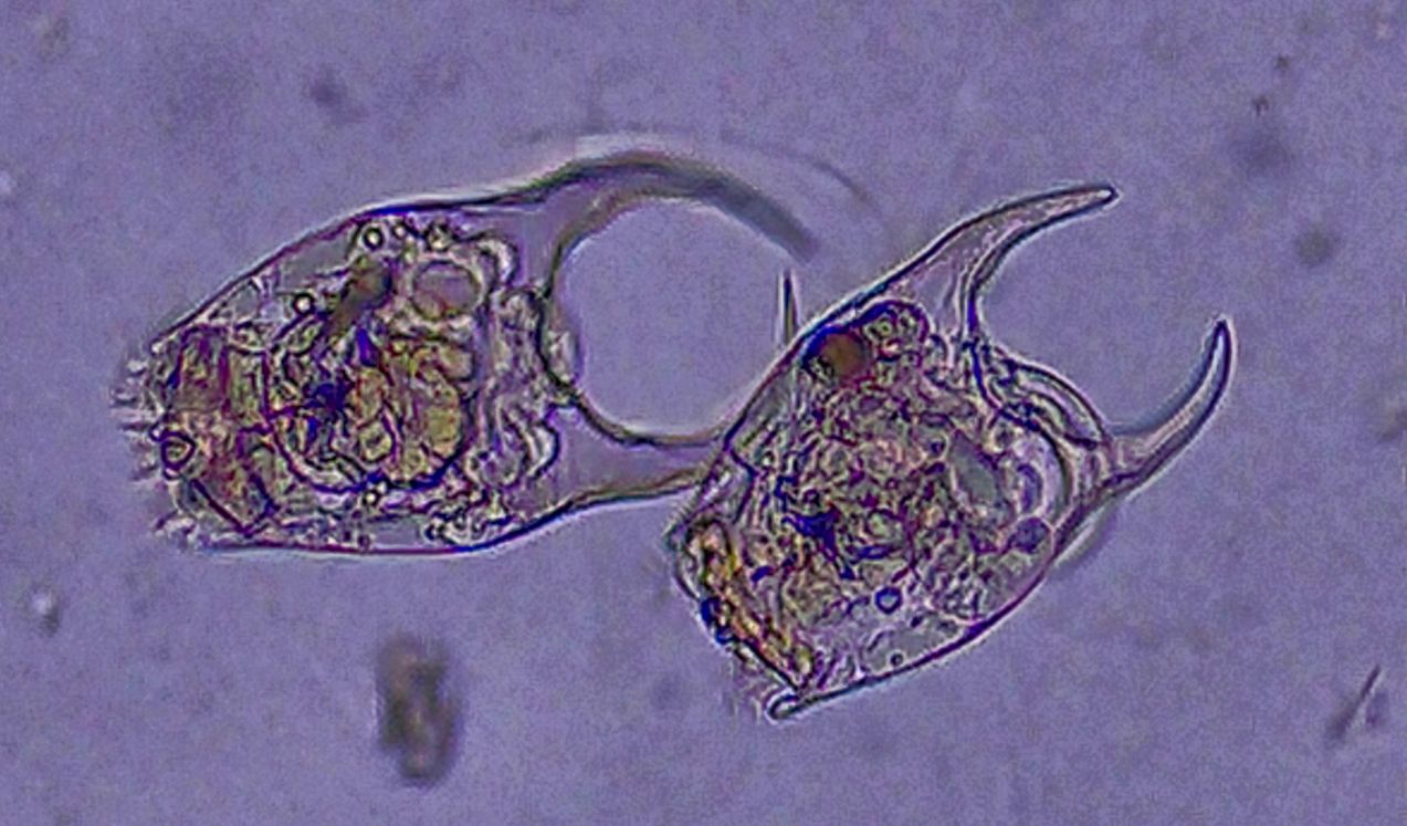 L�ingegnere idrodinamico dello stagno: alla scoperta del rotifero Brachionus